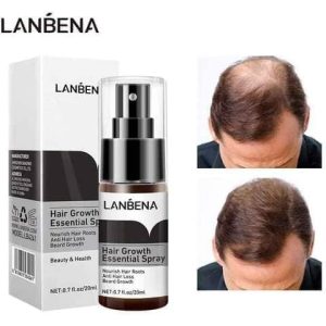 Lanbena hair growth essential spray PRICE IN BANGLADESH cLOUD SHOP BD CLOUDSHOPBD.COM