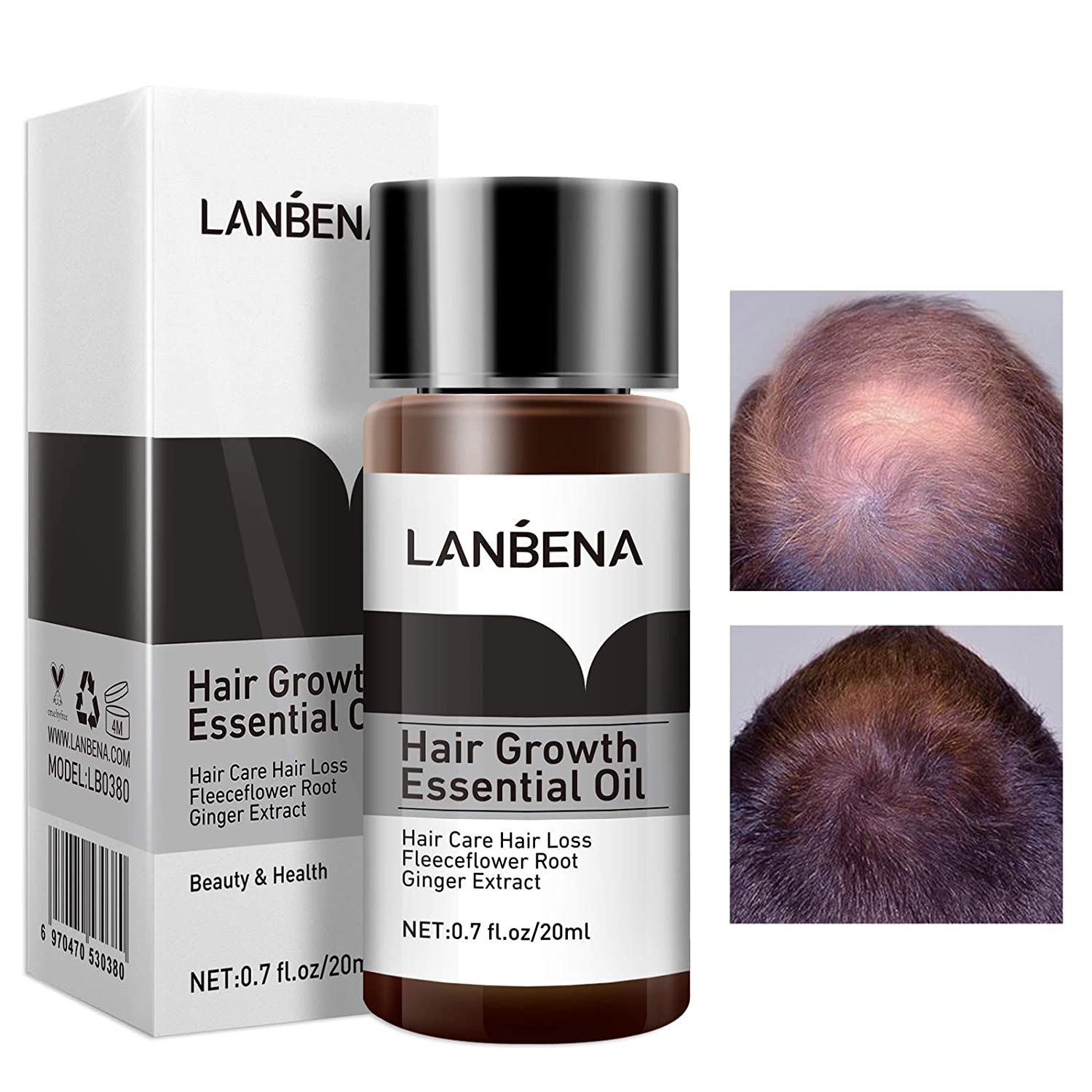 Lanbena hair growth essential spray PRICE IN BANGLADESH cLOUD SHOP BD CLOUDSHOPBD.COM