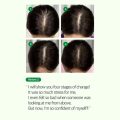 Some By Mi Cica Peptide Anti Hair Loss Derma Scalp Shampoo- 285ml