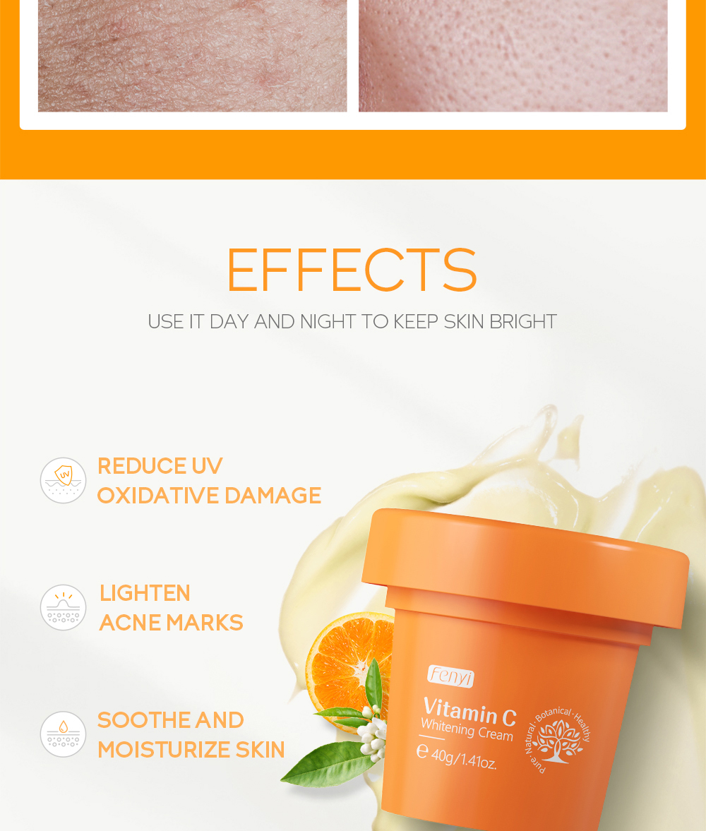 Buy Fenyi Vitamin C Whitening Cream Online From - CloudShopBD.com