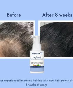 Alternative view of WishCare Hair Growth Serum Concentrate - 30ml