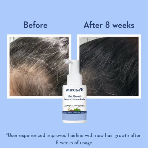 WishCare Hair Growth Serum Concentrate - 30ml - Image 2