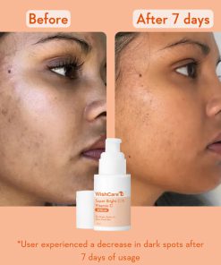 Alternative view of WishCare Super Bright Vitamin C16 Serum - 30ml