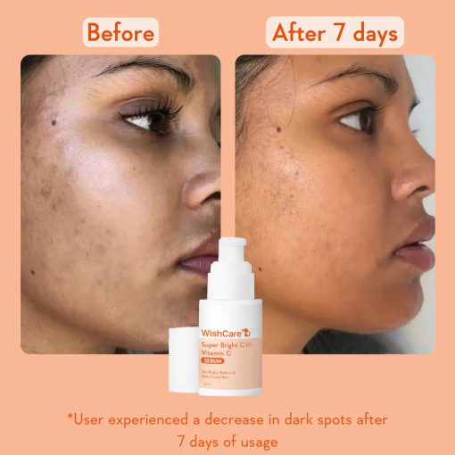 WishCare Super Bright Vitamin C16 Serum - 30ml - Image 2